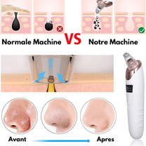 Appareil électrique 5 en 1 pour l'extraction des points noirs
