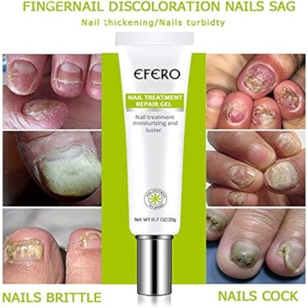 GEL RÉPARATEUR ONGLES EFERO