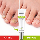 GEL RÉPARATEUR ONGLES EFERO