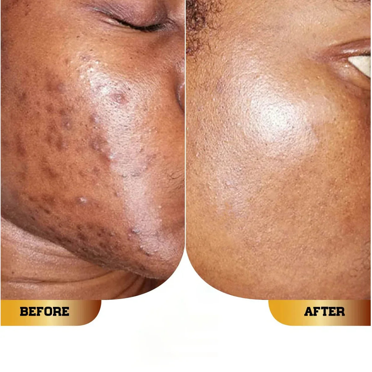 Sérum Anti-Imperfections !