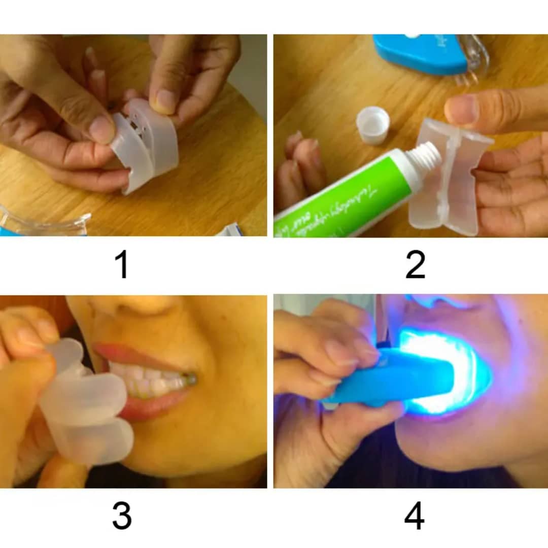 Kit de Blanchiment Dentaire LED – Sourire Éclatant dès la 1ʳᵉ utilisation