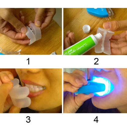 Kit de Blanchiment Dentaire LED – Sourire Éclatant dès la 1ʳᵉ utilisation