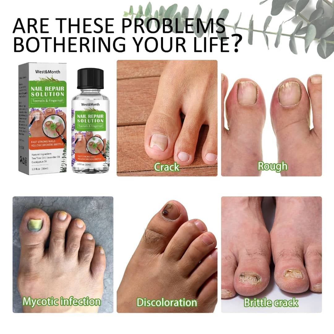 Nail Repair Solution – Ongles abîmés / jaunes / cassants