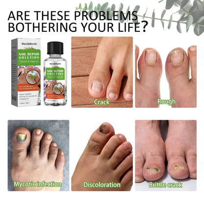 Nail Repair Solution – Ongles abîmés / jaunes / cassants
