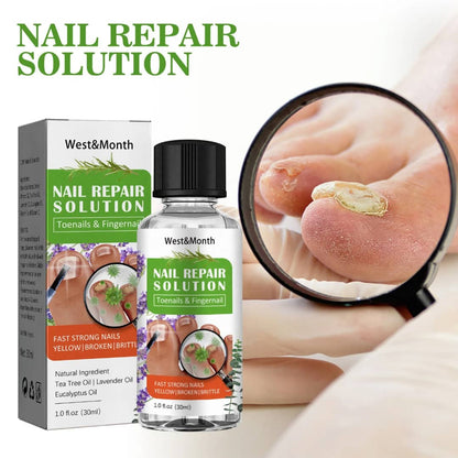 Nail Repair Solution – Ongles abîmés / jaunes / cassants