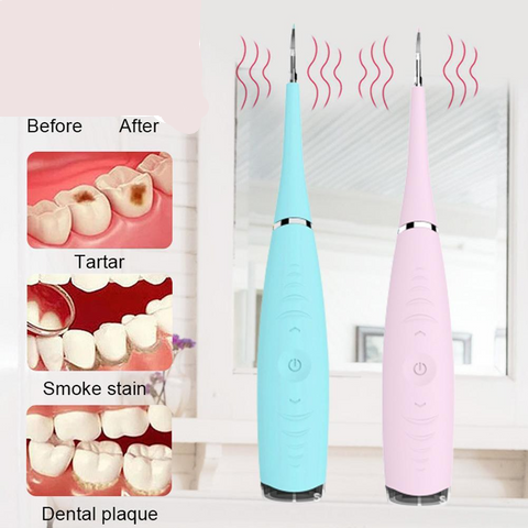 Détartreur Dentaire Electrique Anticalcaire