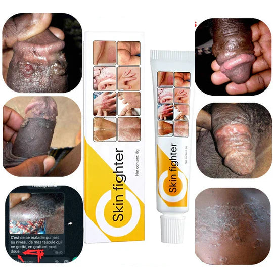 Crème anti-infection/ Démangeaisons / Grattage